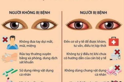 Tuyên truyền phòng chống đau mắt đỏ